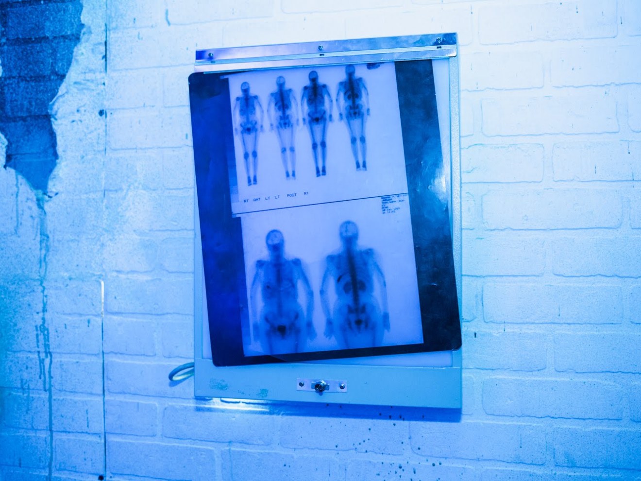 blue image with x-rays of skeletons on wall